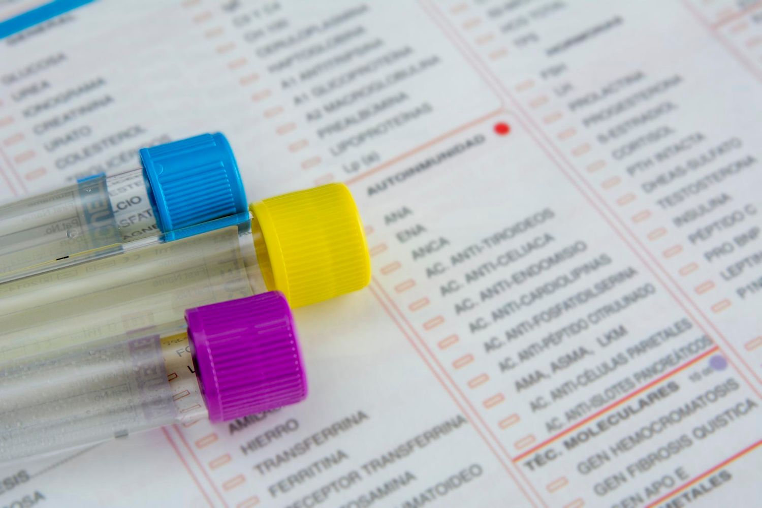 Three medical test tubes with blue, yellow
